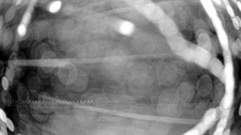 Weather camera view of Gilbert Run Park.