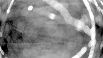 Weather camera view of Gilbert Run Park.