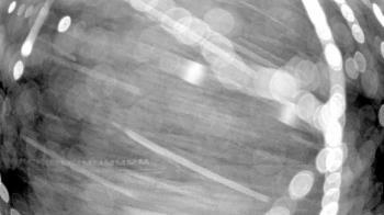 Weather camera view of Gilbert Run Park.