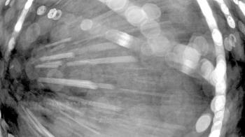 Weather camera view of Gilbert Run Park.