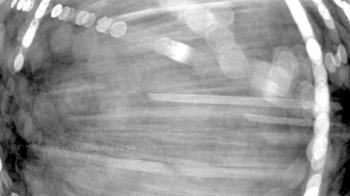 Weather camera view of Gilbert Run Park.