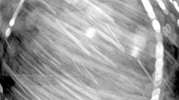 Weather camera view of Gilbert Run Park.