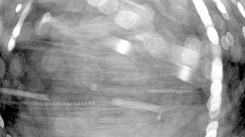 Weather camera view of Gilbert Run Park.