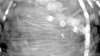 Weather camera view of Gilbert Run Park.