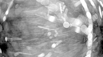 Weather camera view of Gilbert Run Park.