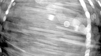 Weather camera view of Gilbert Run Park.