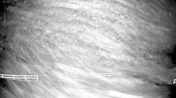 Weather camera view of White Plains Regional Park.