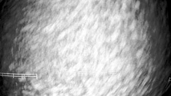 Weather camera view of White Plains Regional Park.