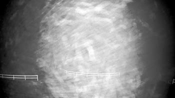 Weather camera view of White Plains Regional Park.