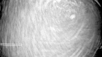 Weather camera view of White Plains Regional Park.