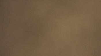 Weather camera view of Chippenham Hospital.