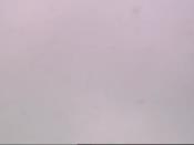 Weather camera view of Kettering MS.