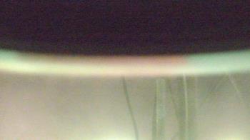 Weather camera view of DeTar Women / Children Hosp.