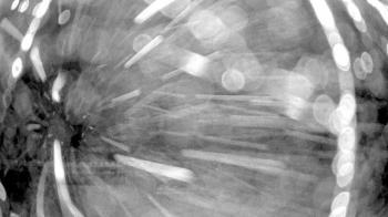 Weather camera view of Gilbert Run Park.