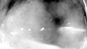 Weather camera view of North Putnam MS.