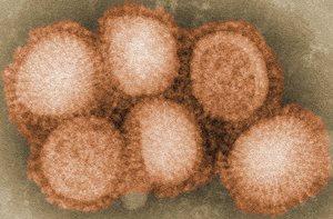 A strain of flu virus is highly magnified in this file image from the CDC via the Wikipedia.