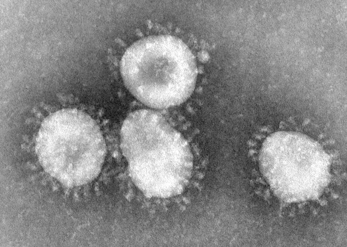 One of the viruses that cause the common cold.