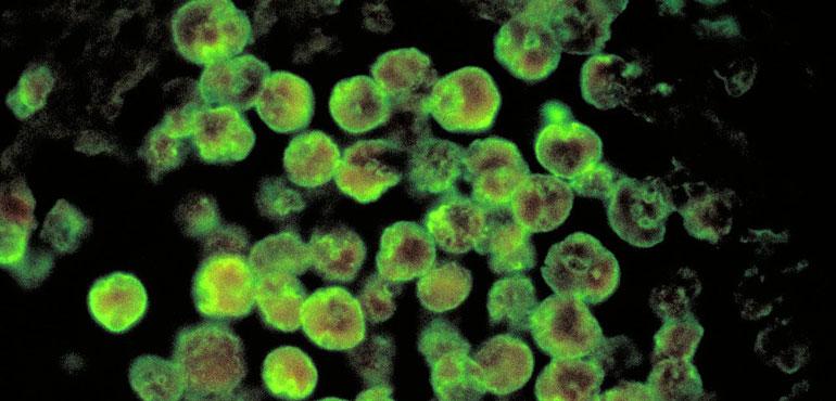 The life and pathology of Naegleria fowleri.